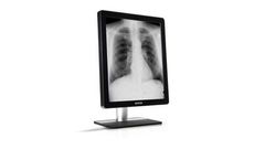 Coronis - Model 5MP LED (MDCG-5221) - Mammography Display