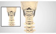 PCF Patient Animation - Video