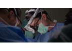 Nuvasive - Model XLIF - Corpectomy Technique
