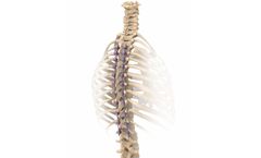NuVasive - Adolescent Idiopathic Scoliosis (AIS)