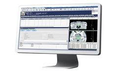 MOSAIQ - Radiation Oncology Information System