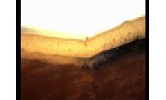 AQUACEL Foam - Intimate Contact - Video