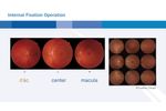 Topcon TRC NW400, non-mydriatic fundus camera - Video