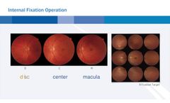 Topcon TRC NW400, non-mydriatic fundus camera - Video