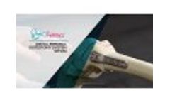 Distal Femoral Osteotomy System (DFOS) Sawbones Demonstration - Video