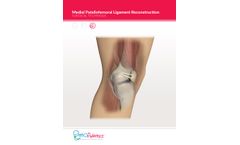 OrthoPediatrics - Model MPFL - Reconstruction System  - Brochure