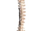 ApiFix - Model MID-C - Adolescent Idiopathic Scoliosis (AIS)