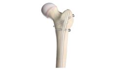 Pediatric Nailing Platform - Femur