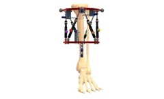 ORTHEX - Large Bone Circular Fixator