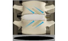 Model STALIF L - Integrated Interbody™ System