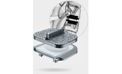 Model Prodisc C Nova - Anterior Cervical Total Disc Replacement