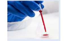 Atonarp - Model 360 - Revolutionary Optical Spectroscopy Molecular Sensor