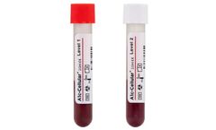 A1c-Cellular - HbA1c Control With Intact Red Blood Cells