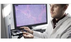 Indivumed - Biomarker Discovery and Validation Services