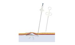 Carter-Thomason - Suture Passer