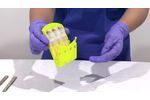 Remove Scalpel Blades in the Sterile Field Using Qlicksmart BladeCASSETTE - Video