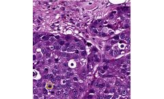 Virasoft - Mitosis Analysis Technology
