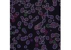 Fluorescent - Fluorescent in Situ Hybridization Technology