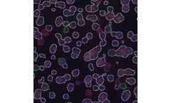 Fluorescent - Fluorescent in Situ Hybridization Technology