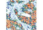 Virasoft - Model HER2 - Epidermal Growth Factor Receptor 2