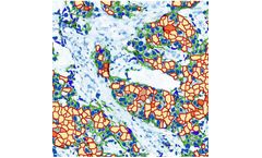Virasoft - Model HER2 - Epidermal Growth Factor Receptor 2