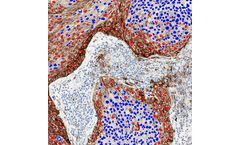 Virasoft - Model PD-L1 - Programmed Cell Death Protein