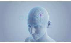 RTsafe Personalized PseudoPatient - Video