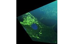 Gain - Model See-Tx - Site-Directed Enzyme Enhancement Therapy (See-Tx) Platform