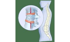 Traumatic Injury to the Bones and Joints