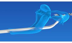 memic Overview 2021 - Video