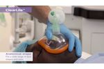 ClearLite anesthetic face masks - a clear vision for the future (USA) - Video