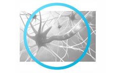Neuromodtronic - Eyetronic Therapy Services