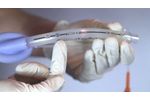 Laryngeal Mask Airway Insertion | LarySeal - Video