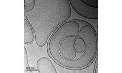 BioSeizer - Model TLC399 - Macular Edema
