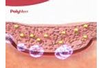 How PolyMem wound dressings work - Video