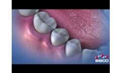 Duo-Link Universal Whiteboard - Video