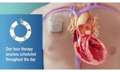 An Overview of CCM Therapy for Medical Professionals - Video