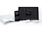 Telemed - Model MicrUs PRO - Open-Architecture B/W Ultrasound Diagnostic System