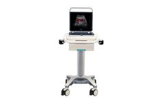 Shimai - Model M60 - Standard Portable Color Ultrasound Machine Two Probes