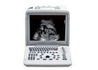 Shimai - Model M30 - Portable Black and White Ultrasound Equipment with Two Probes