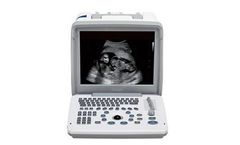 Shimai - Model M30 - Portable Black and White Ultrasound Equipment with Two Probes