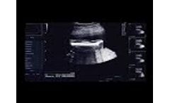 Auto Biometry - Video