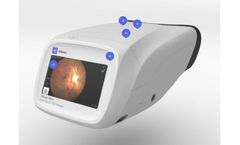 RetinaVue - Model 700 - Retinal Imager