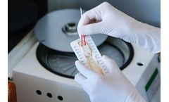 RAM Scientific - Model SAFE-T-FILL - Micro Hematocrit Tubes