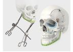 LeForte - Plate and Screw for Craniomaxillofacial Surgery