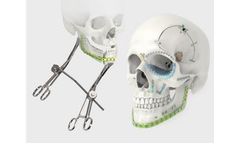 LeForte - Plate and Screw for Craniomaxillofacial Surgery