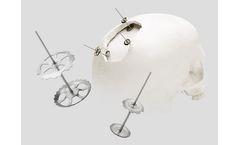 Speedy Flap - Cranial Bone Flap Fixation System