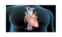 Acorys - Medical Device - Video