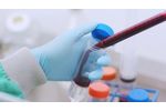 Our Research: A Rich Cell Therapy Pipeline for the Future - Video