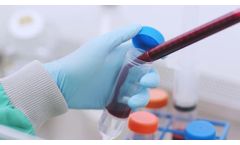 Our Research: A Rich Cell Therapy Pipeline for the Future - Video
